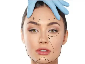 بهترین سن برای لیفت با نخ ؟