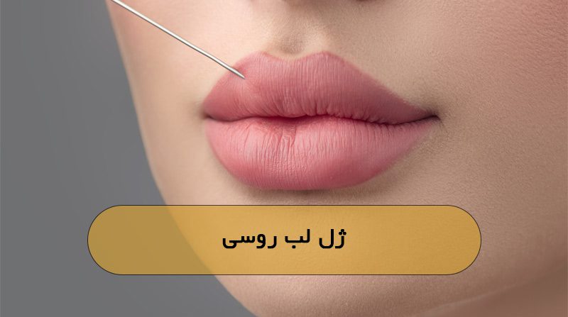 فیلر لب روسی چیست؟