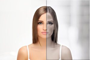 مهمترین عوارض مزوژل را بشناسید!