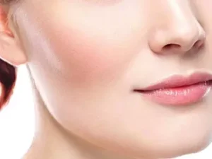 تزریق کات گونه در دزفول
