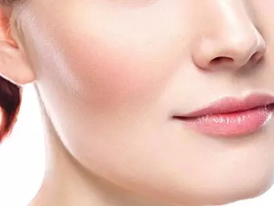 تزریق کات گونه در دزفول