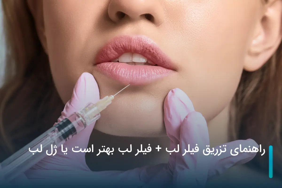 مهم‌ ترین تفاوت تزریق ژل لب با فیلر لب در چیست؟